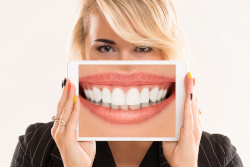 fluorose-dentaire-definition-et-symptomes-dentiste-paris-13