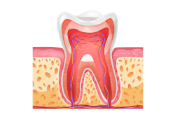urgence-dentaire-qu-est-ce-qu-une-urgence-endodontique-dentiste-paris-13